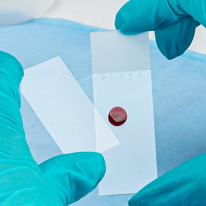 Microscoop-Slides – Objectglaasjes – Preparaatglaasjes – Microscoopglaasjes – Glasplaatjes – Frosted Aan 1 Zijde, Geslepen Randen – Optisch Wit Glas, 25 x 75 mm, Voorgereinigd