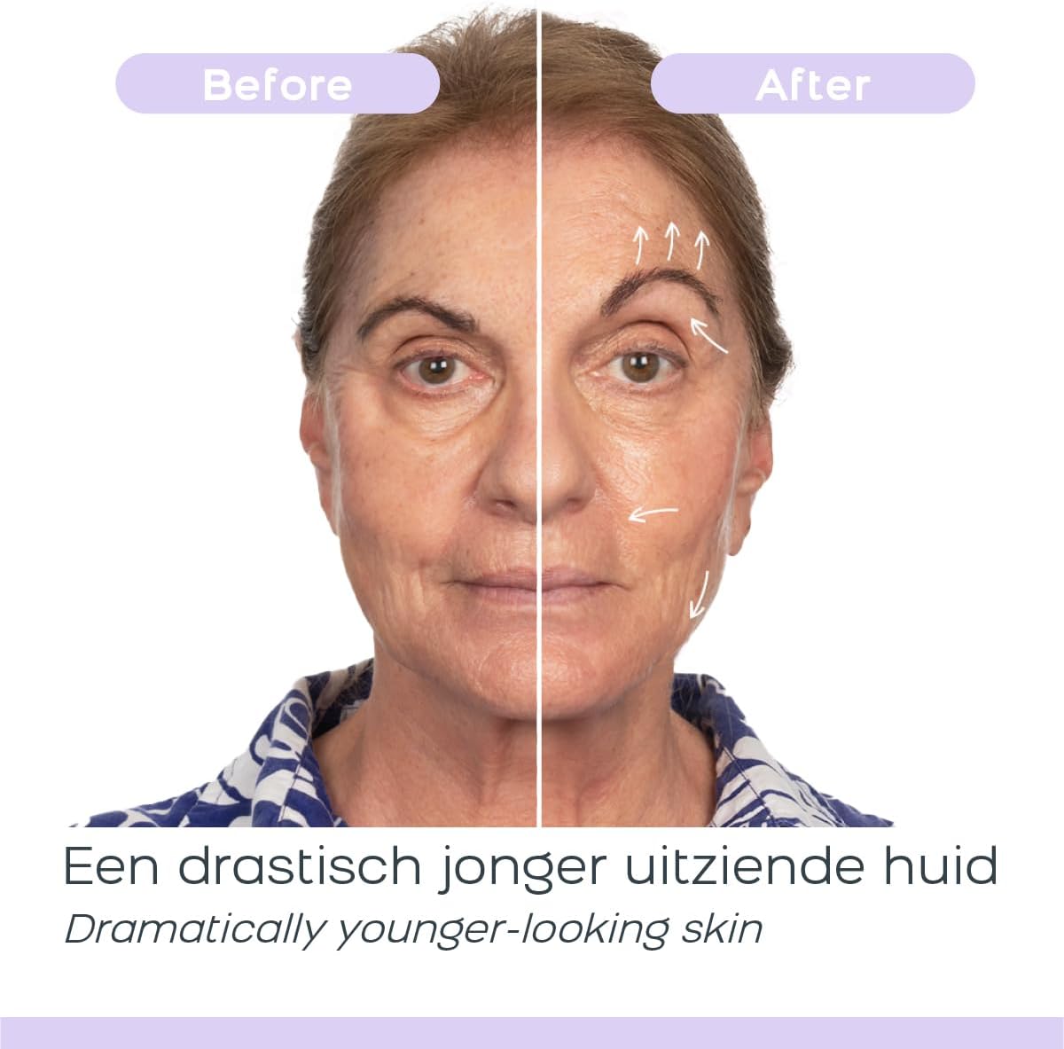 Microstroom Gezichtsapparaat – Huidverzorgingsapparaat – Gezichtsverzorgingsapparaat – Gezichtsmassageapparaat – Anti-Aging Apparaat – Instelbare Intensiteit – Dagelijks 3-5 Min Gebruik