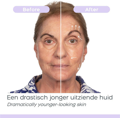 Microstroom Gezichtsapparaat – Huidverzorgingsapparaat – Gezichtsverzorgingsapparaat – Gezichtsmassageapparaat – Anti-Aging Apparaat – Instelbare Intensiteit – Dagelijks 3-5 Min Gebruik