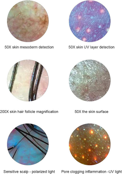 Haaranalysator voor huiddiagnose, 15,6 inch 50 x 200 X-objectief, huid-haar-hoofdhuiddetector, hoofdhuidmicroscoop, haarfollikel-huid-hoofdhuidanalysator met 3 lichtmodi, volledig beeld, contrastopslag (EU)