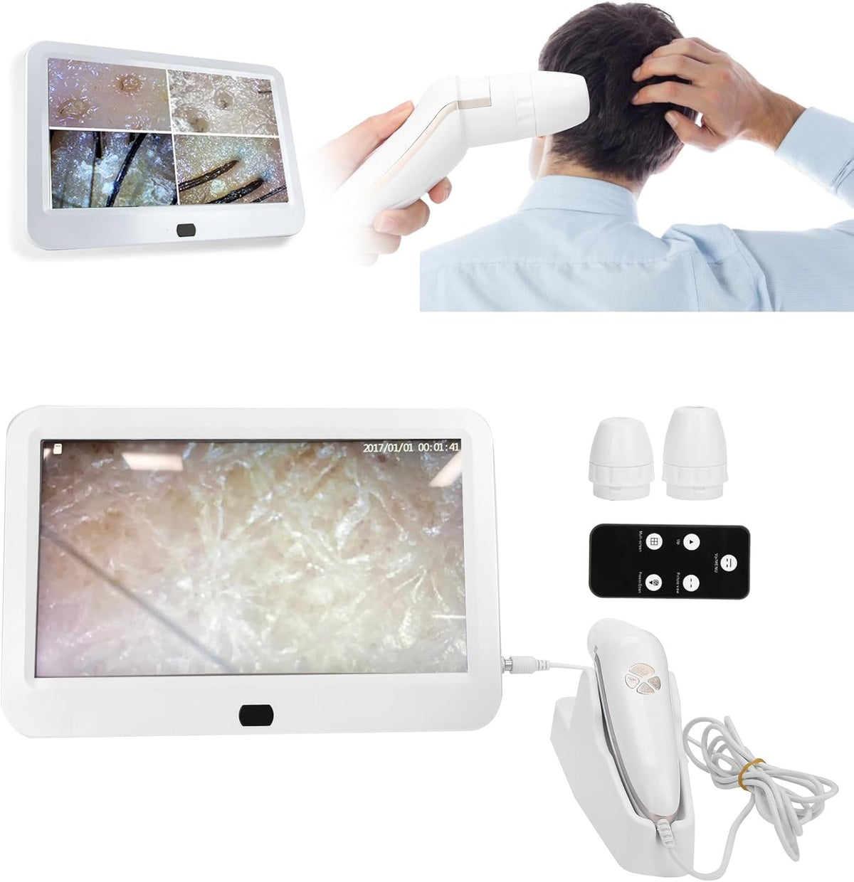 Haaranalysator voor huiddiagnose, 15,6 inch 50 x 200 X-objectief, huid-haar-hoofdhuiddetector, hoofdhuidmicroscoop, haarfollikel-huid-hoofdhuidanalysator met 3 lichtmodi, volledig beeld, contrastopslag (EU)