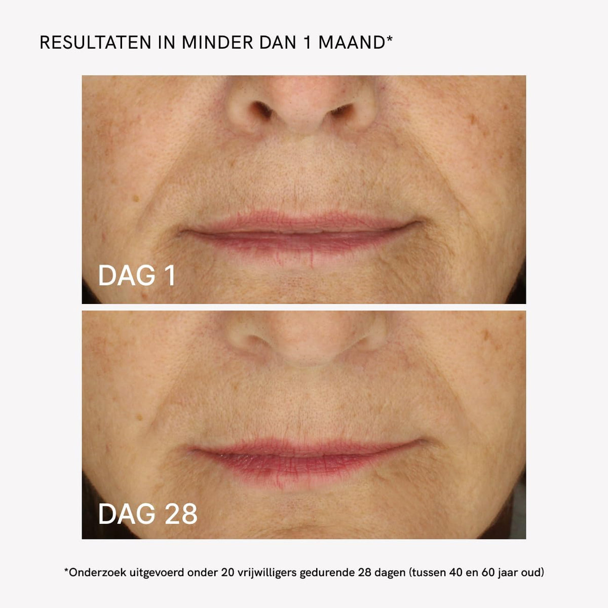 Radiofrequentie Gezichtsapparaat – RF Apparaat – Gezichtsverstevigingsapparaat – Lifting Apparaat – Anti-Rimpel Massageapparaat – Inclusief 500 Ml Gezichtscrème Met Collageen En Hyaluronzuur – 4 Multifunctionele LED-Modi