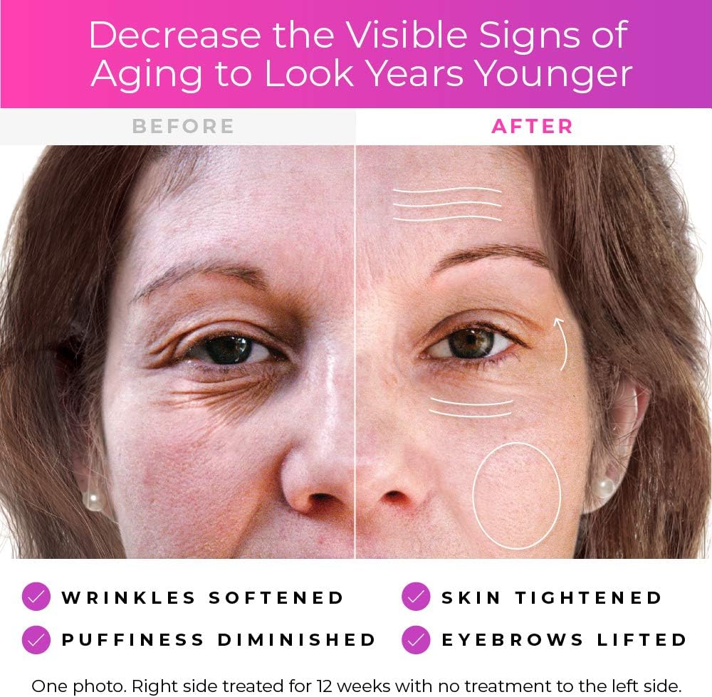 Dermawand, anti-aging systeem met vochtinbrengende crème om rimpels te verminderen, (UK-stekker; compatibiliteit met Duitse systemen niet gegarandeerd).