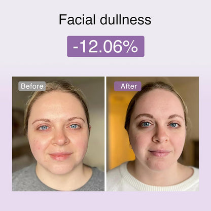 DermRays laser apparaat m1
