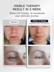 Lichttherapie - Rood Licht Therapie - LED-Therapie - LED-masker - Nabij-Infrarood Roodlicht - voor Gezicht - Flexibel Siliconen Lichttherapiemasker - voor Thuis - Gezichtsmaskers - Huidverzorging - Wit