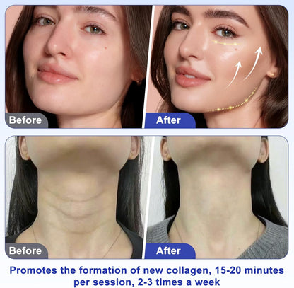 40K Cellulitis Massageapparaat – Anti-Cellulitis Apparaat – Afslankapparaat – Cavitatieapparaat – Radiofrequentieapparaat – 4-In-1 – 10 Intensiteitsniveaus
