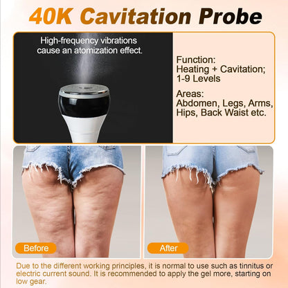 3-In-1 Anti-Cellulitis Massageapparaat – Cavitatie Apparaat – Radiofrequentie Apparaat – Afslankapparaat – Lymfedrainage Apparaat – 40K Cavitatie – 9 Intensiteitsniveaus
