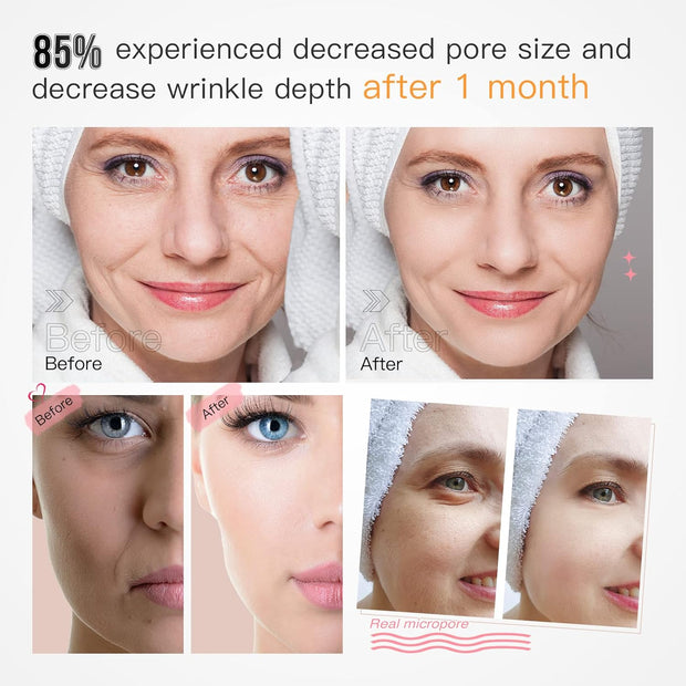 Lichttherapie - Rood Licht Therapie - LED-Therapie - LED-masker - Nabij-Infrarood Roodlicht - voor Gezicht - 3-Kleuren-LED -Verzorgingsapparaat - met Anti-aging - Rimpels - voor Alle Huidtypes - Wit