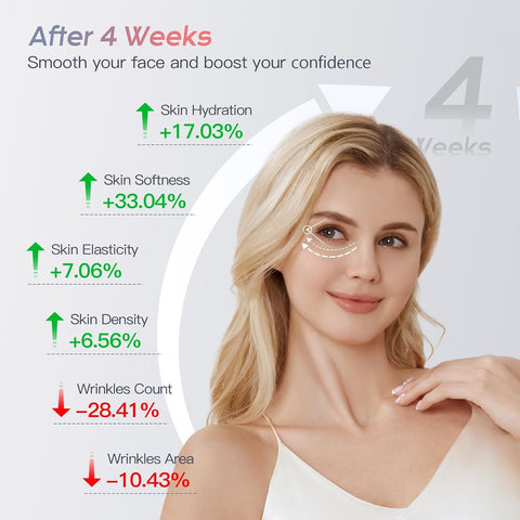 Lichttherapie - Rood Licht Therapie - LED-Therapie - 6-in-1 Hoogfrequent EMS-Gezichtsapparaat - Gezichtsradiofrequentieapparaat - met RF-Functie - Anti-Aging - Anti-Rimpel - Gezichtsmassager- Diepe Reiniging - voor Huidverzorging - Roze