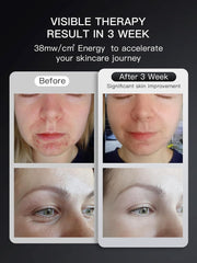 Lichttherapie - Rood Licht Therapie - LED-Therapie - LED-masker - Nabij-Infrarood Roodlicht - voor Gezicht - Flexibel Siliconen Lichttherapiemasker - voor Thuis - Gezichtsmaskers - Huidverzorging - Zwart