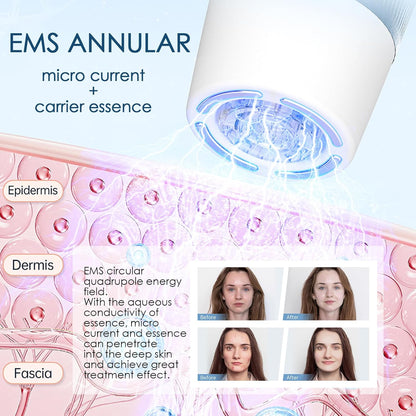 Draadloze Microneedling Pen – Dermapen – Serum Applicator – Essence Apparaat – Microneedling Apparaat – EMS Microstroom – LED Display Met 6 Snelheden En Verstelbare Naaldlengte 0-1,0 Mm