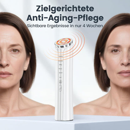 Radiofrequentie Gezichtsverzorgingsapparaat Wit – Gezichtsmassageapparaat, EMS Gezichtsmassageapparaat, Huidverzorgingsapparaat, Elektrisch Gezichtsapparaat – 4-In-1 Met Warmte En Koeling – Ergonomisch Gua Sha Design