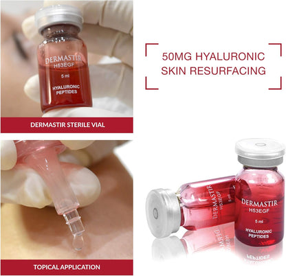 Hyaluronzuur Ampullen 10x5 ml – Serumampullen – Microneedling Ampullen – Steriele Medische Flacons – Injectieflacons – 53 Actieve Ingrediënten – 10 mg/ml Hyaluronzuur