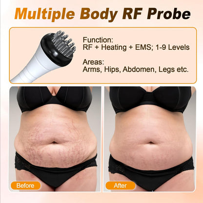 3-In-1 Anti-Cellulitis Massageapparaat – Cavitatie Apparaat – Radiofrequentie Apparaat – Afslankapparaat – Lymfedrainage Apparaat – 40K Cavitatie – 9 Intensiteitsniveaus
