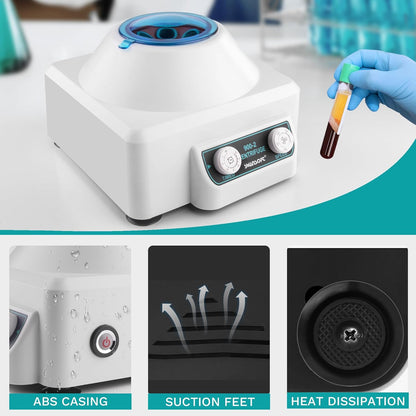 PRP-centrifuge – Tafelcentrifuge – Laboratoriumcentrifuge – Medische Centrifuge – 6 x 10 ml – 0-4000 rpm – 1685 x g, 0-60 minuten timer