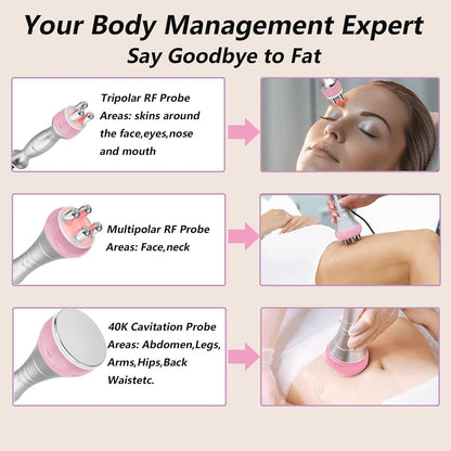 Radiofrequentie-Massageapparaat Voor Gezicht En Lichaam – Afslankapparaat – Cavitatiemachine – Vacuümmassageapparaat – Lichaamsmassageapparaat – 3-In-1 Met Radiofrequentie, Cavitatie En Vacuüm – 4 Energieniveaus En 10 Intensiteiten