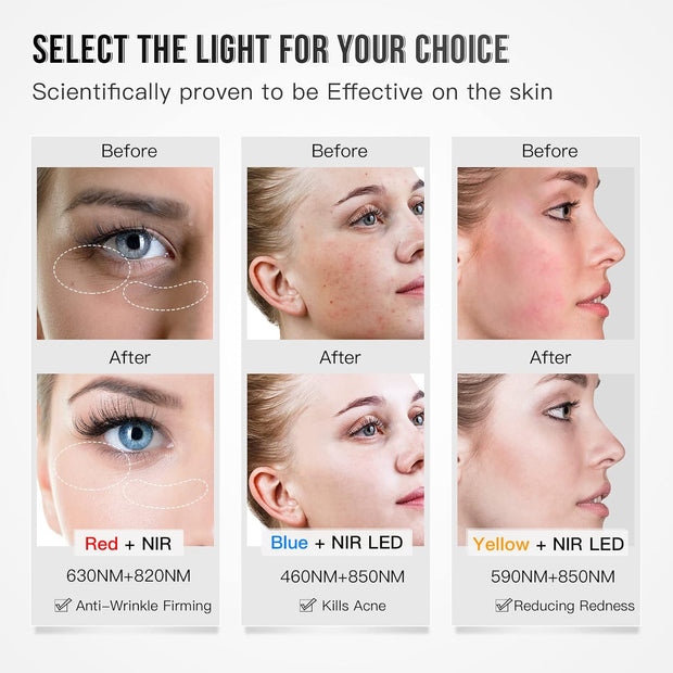 Lichttherapie - Rood Licht Therapie - LED-Therapie - LED-masker - Nabij-Infrarood Roodlicht - voor Gezicht - 3-Kleuren-LED -Verzorgingsapparaat - met Anti-aging - Rimpels - voor Alle Huidtypes - Wit