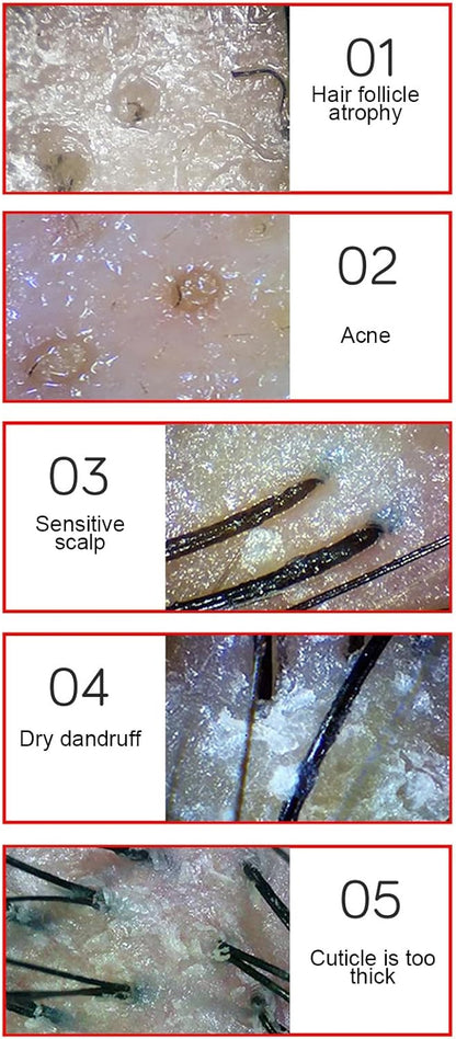 Haaranalysator voor huiddiagnose, 15,6 inch 50 x 200 X-objectief, huid-haar-hoofdhuiddetector, hoofdhuidmicroscoop, haarfollikel-huid-hoofdhuidanalysator met 3 lichtmodi, volledig beeld, contrastopslag (EU)