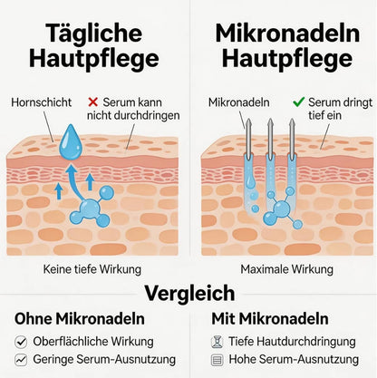 Microneedling pen – Dermapen – Mesopen – Huidverzorgingspen – Beauty pen – 3-In-1 met EMS-Microstroom en LED-Licht – 5 Snelheden en Intelligente Sensorbasis