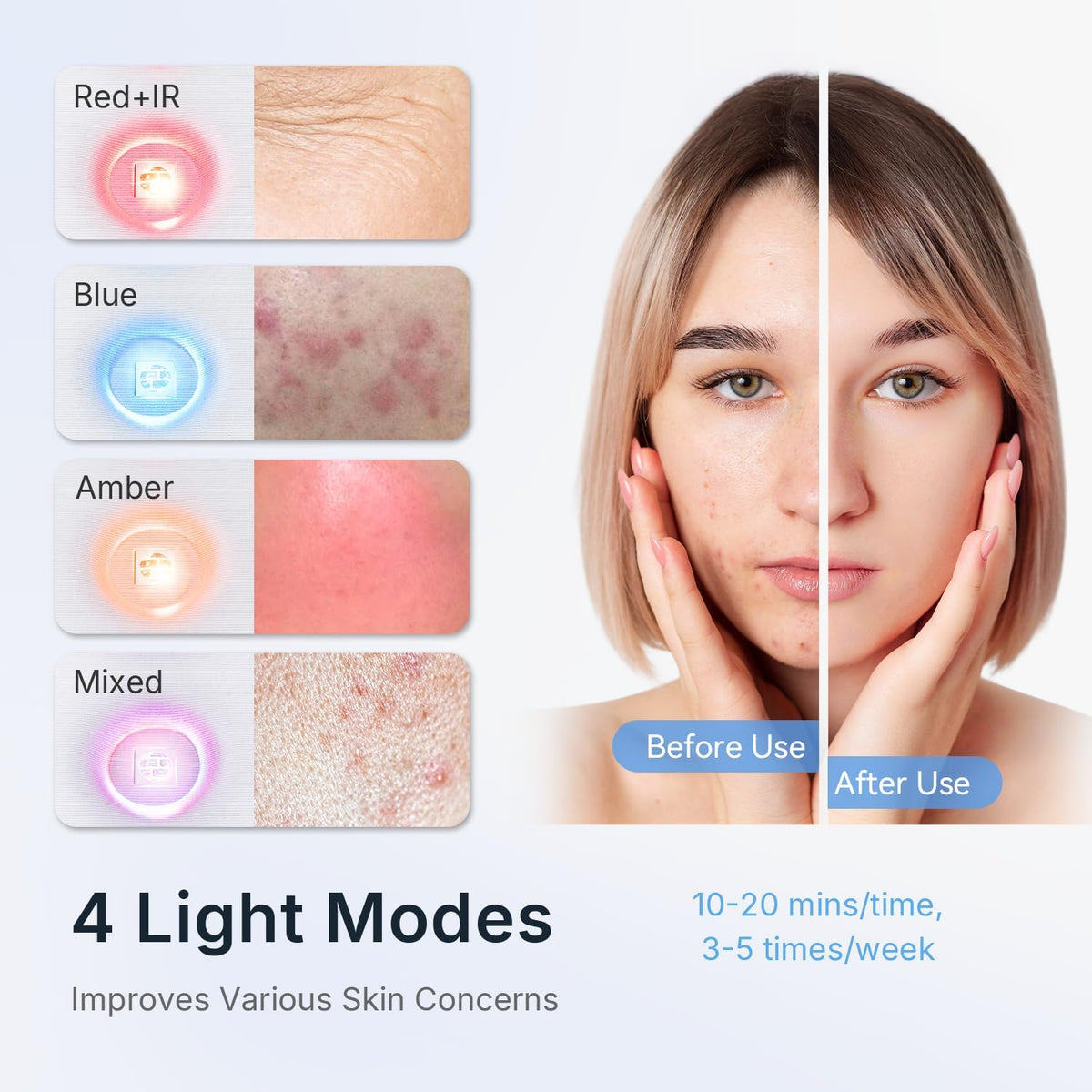 FDA Goedgekeurde Rode Lichttherapie voor Gezicht, 4 Modi Led Gezichtsmasker Foton Lichttherapie, Blauw Rood Licht Nabij Infrarood Rood Lichttherapie Masker, PDT Professioneel Salonapparaat voor