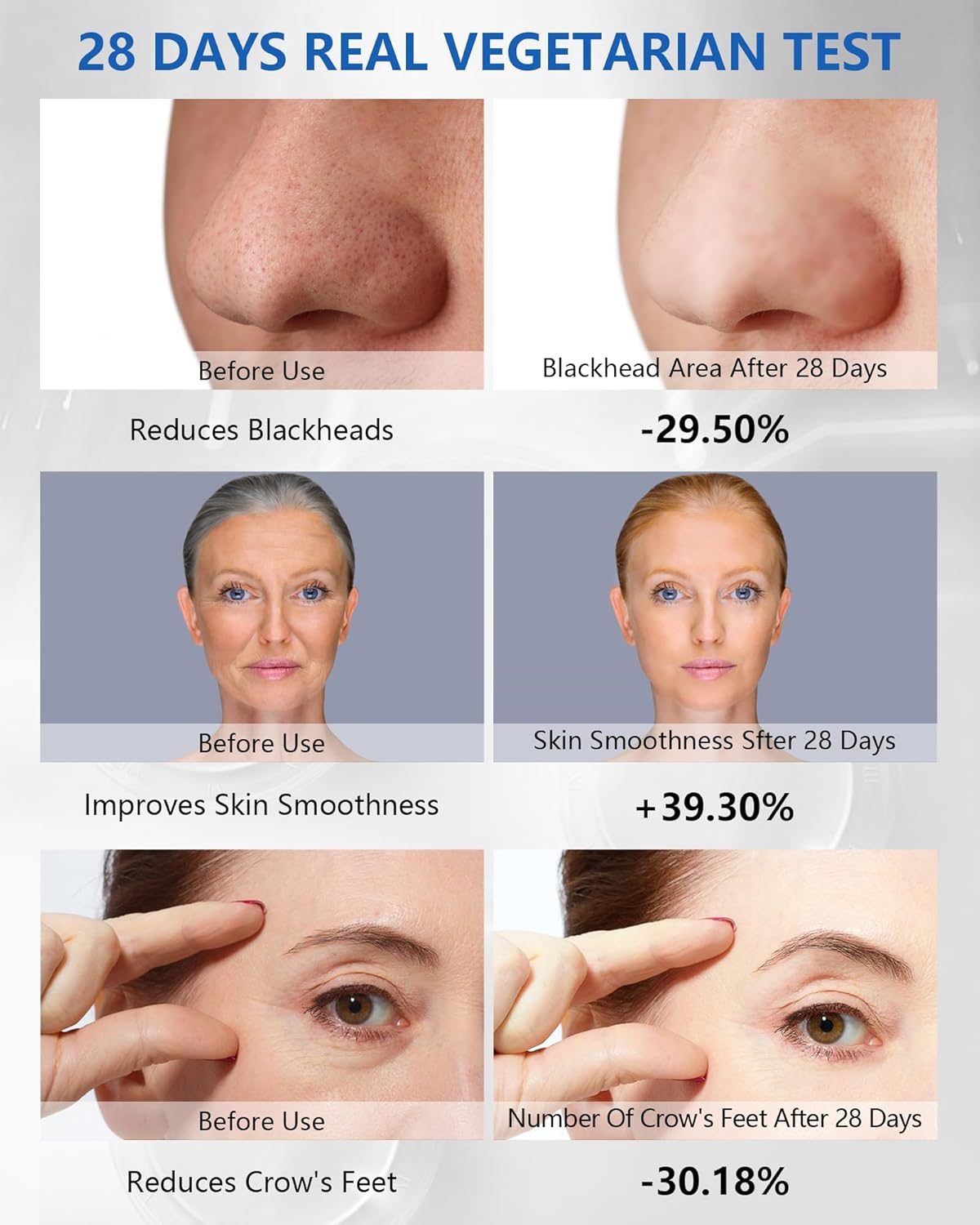 Red Light Radio Frequency Beauty Device, Red Light Therapy + RF + EMS 3-in-1, Face Massager for Face Tightening, Skin Tightening, Anti-Aging, Skin Rejuvenation