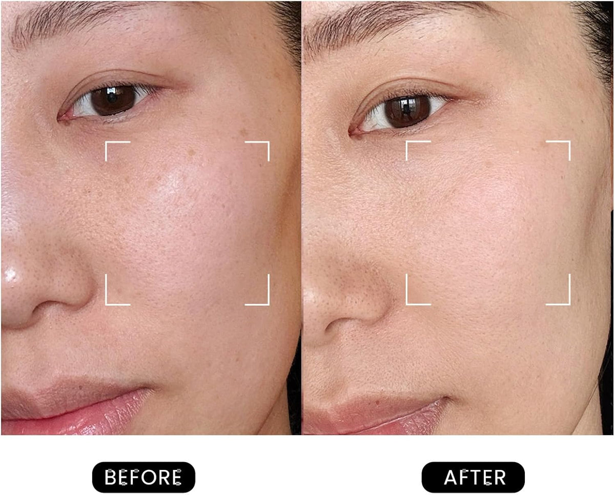 DermRays Laserapparaat 1064 nm multifunctioneel schoonheidsapparaat, gezichtsmassageapparaat, voor thuisgebruik