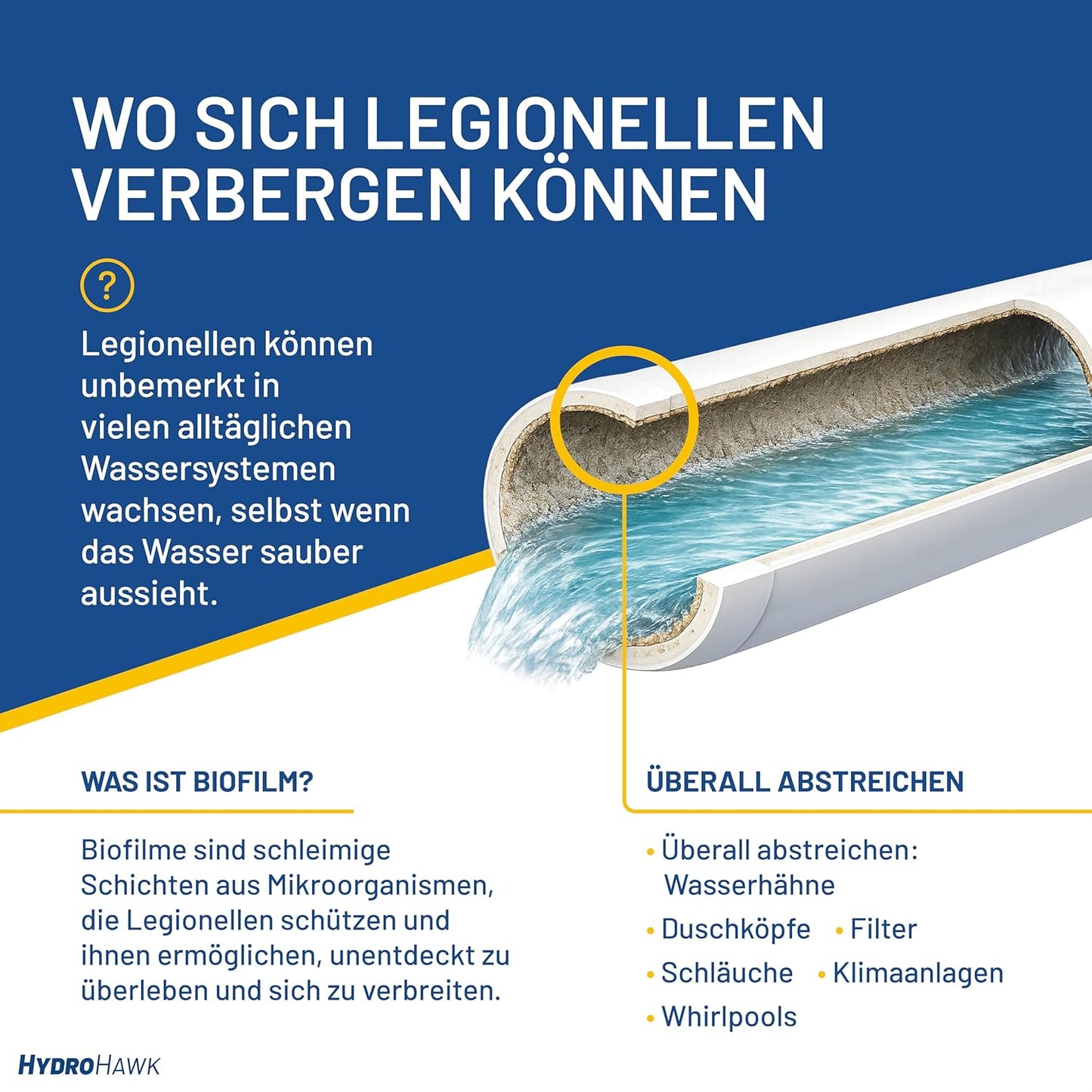Legionella Swab Test Waterpunten, 5x Gebruiksklare Kit Detectie Legionella pneumophila SG1, Pool, Airco, Hot Tub, Douchekop, Kraan, Tuinslang – 25 Min Thuis Test