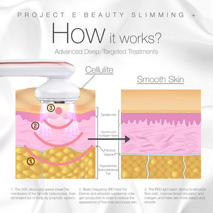 LED+ Radiofrequentie Slimming Therapie – Cavitatie Apparaat – Body Shaper – Lichaamsmassager – Vormgevend Apparaat – 3-In-1 Technologie – 3 Intensiteitsniveaus