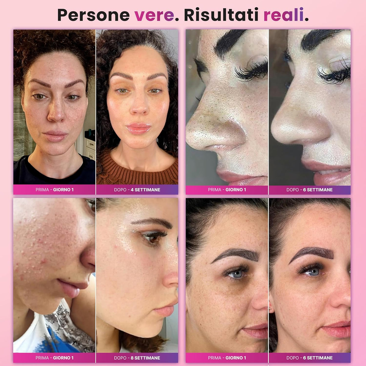 Diamond Pro Peeling met diamantpoeder, professionele mee-eterafzuiger, microdermabrasie, gezichtsreiniging, mee-eterverwijderaar, poriënextractor, 4-in-1 apparaat