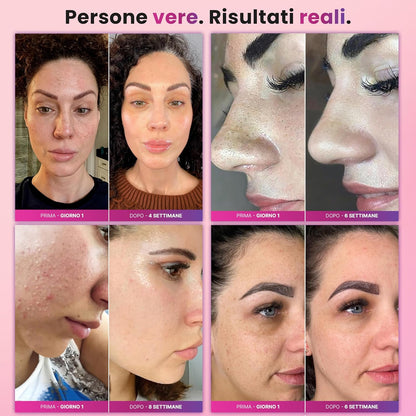 Diamond Pro, peeling met diamantstof, professionele mee-eterzuiger, microdermabrasie, gezichtsreiniging, mee-eterverwijderaar, poriënverwijderaar, 4-in-1 apparaat