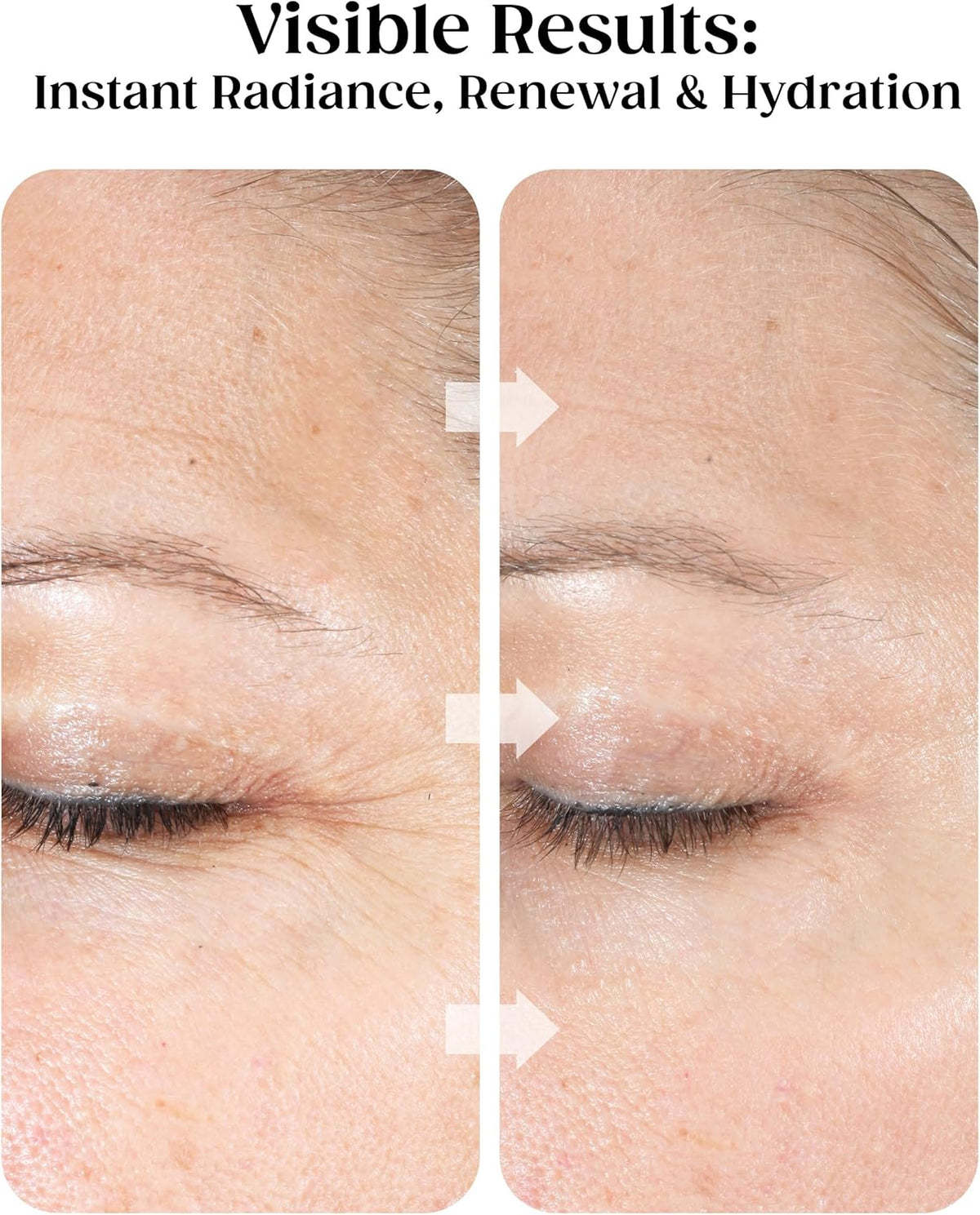 Anti-Aging Gezichtsbehandeling – Gezichtsverzorging – Huidbehandeling – Facial – Gezichtspeeling – 4-In-1 – 1 Minuut – 88,7 Ml