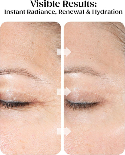 Anti-Aging Gezichtsbehandeling – Gezichtsverzorging – Huidbehandeling – Facial – Gezichtspeeling – 4-In-1 – 1 Minuut – 88,7 Ml