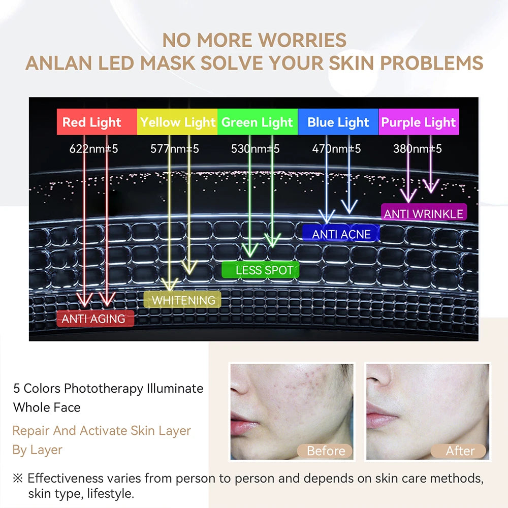 LED Gezichtsmaker - 5 Kleuren - Face Mask - Lichttherapie - Masker voor Gezicht - Tegen Acne, Droge Huid & Rimpels - Wit - QUORE