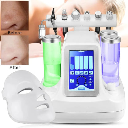 7-in-1 Water Oxygen Beauty Machine – Schoonheidsapparaat – Huidverzorging – Gezichtsbehandeling – Anti-Acne – Microdermabrasie – Instelbare Intensiteit