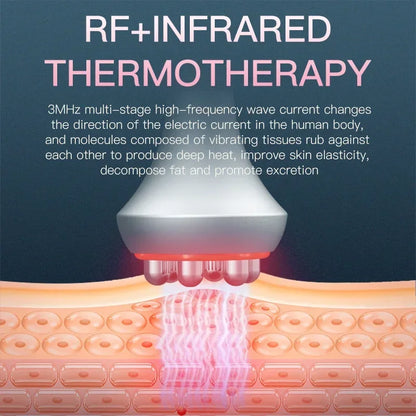 6-In-1 Ultrasonische Vetverbrandingsmachine – Vetreductie Apparaat – Cavitatie Machine – Lasertherapie – Vacuümtherapie – 80 kHz Ultrasoon – 300W Vermogen - QUORE