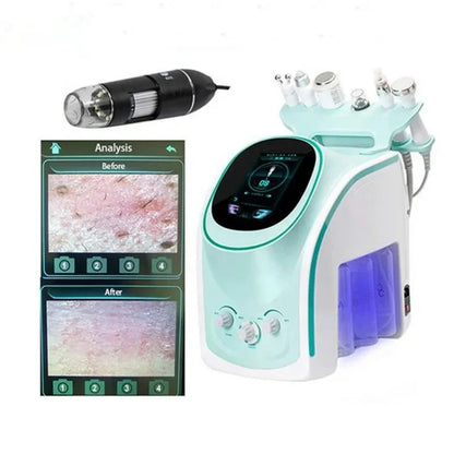 6-in-1 Hydrodermabrasie Machine – Huidverzorgingsapparaat – Gezichtsreinigingsapparaat – Anti-Acne – Huidverjonging – 35W Vermogen – Vacuum Tot 90 kPa