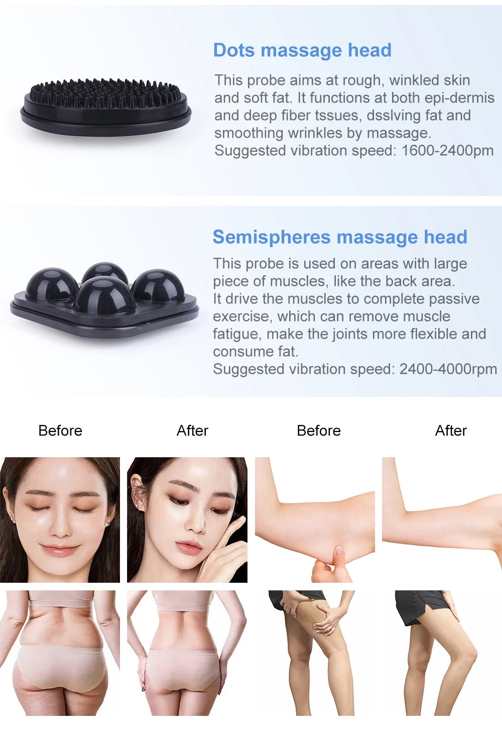 G5 Trillingsmassager – Electrische Massager – Vetverbrandingsapparaat – Cellulite Behandelaar – Spierontspanner – Vijf Massagekoppen – Stevig ABS Materiaal – Groot Formaat