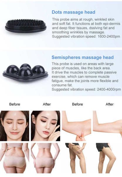 G5 Trillingsmassager – Electrische Massager – Vetverbrandingsapparaat – Cellulite Behandelaar – Spierontspanner – Vijf Massagekoppen – Stevig ABS Materiaal – Groot Formaat